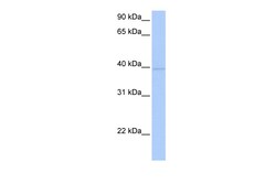 Aviva Systems Biology Corp ZNF385D Antibody - C-terminal region (ARP50685_P050)