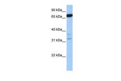 Aviva Systems Biology Corp ZBTB46 Antibody - N-terminal region (ARP50690_P050)
