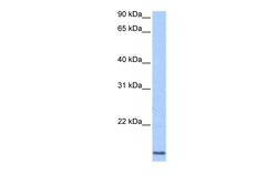 Aviva Systems Biology Corp CCNL2 Antibody - N-terminal region (ARP50695_P050)