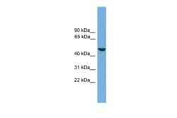Aviva Systems Biology Corp ZMAT1 Antibody - middle region (ARP50721_P050)