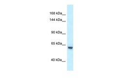 Aviva Systems Biology Corp Zfp354a Antibody - C-terminal region (ARP50736_P050)