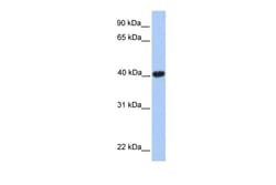 Aviva Systems Biology Corp MGC29891 Antibody - C-terminal region (ARP50783_P050)