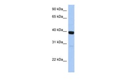 Aviva Systems Biology Corp ZNF385B Antibody - C-terminal region (ARP50803_P050)