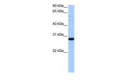 Aviva Systems Biology Corp C1orf83 Antibody - N-terminal region (ARP50810_P050)
