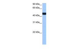 Aviva Systems Biology Corp LIN9 Antibody - N-terminal region (ARP50821_P050)