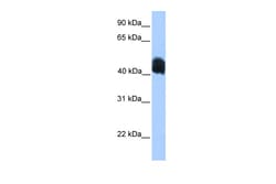 Aviva Systems Biology Corp MDFIC Antibody - N-terminal region (ARP50877_P050)