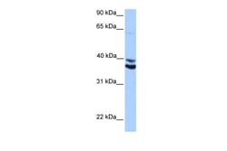 Aviva Systems Biology Corp MDFIC Antibody - middle region (ARP50878_P050)