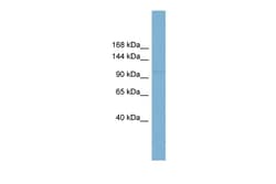 Aviva Systems Biology Corp RBBP8 Antibody - middle region (ARP50888_P050)