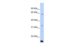 Aviva Systems Biology Corp ARID5A Antibody - C-terminal region (ARP50912_P050)