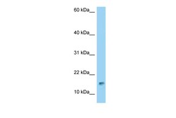 Aviva Systems Biology Corp LOC730644 ANTIBODY 50UG/50UL, Quantity: Each
