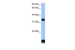 Aviva Systems Biology Corp FOXI3 Antibody - middle region (ARP51009_P050)