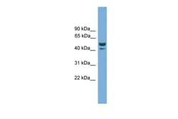 Aviva Systems Biology Corp hCG_2007354 Antibody - N-terminal region (ARP51074_P050)