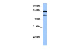 Aviva Systems Biology Corp hCG_2042202 Antibody - C-terminal region (ARP51085_P050)