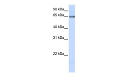 Aviva Systems Biology Corp DCLRE1C Antibody - C-terminal region (ARP51165_P050)