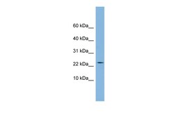 Aviva Systems Biology Corp PPIL3 Antibody - middle region (ARP51174_P050)