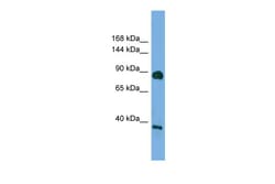 Aviva Systems Biology Corp DLG4 Antibody - middle region (ARP51199_P050)