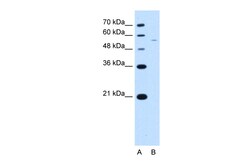 Aviva Systems Biology Corp RSRC2 Antibody - C-terminal region (ARP51202_T100)
