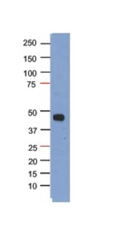 Aviva Systems Biology Corp PHF6 Antibody - N-terminal region (ARP51237_T100)