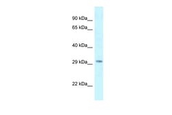 Aviva Systems Biology Corp KMT5B Antibody - C-terminal region (ARP51247_P050)