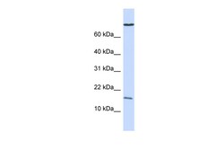 Aviva Systems Biology Corp GABARAP Antibody - N-terminal region (ARP51265_P050)