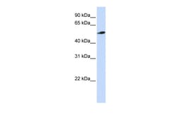Aviva Systems Biology Corp C10orf33 Antibody - N-terminal region (ARP51276_P050)