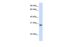 Aviva Systems Biology Corp TNNT3 Antibody - C-terminal region (ARP51286_P050)