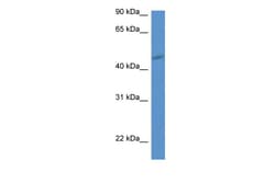 Aviva Systems Biology Corp P2ry1 Antibody - middle region (ARP51290_P050)