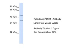 Aviva Systems Biology Corp P2RY1 Antibody - N-terminal region (ARP51293_P050)