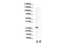 Aviva Systems Biology Corp ASPH Antibody - N-terminal region (ARP51356_P050)