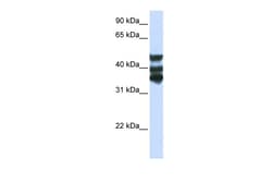 Aviva Systems Biology Corp HGD Antibody - middle region (ARP51477_P050)