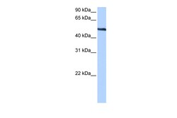 Aviva Systems Biology Corp TRIP6 Antibody - middle region (ARP51618_P050)
