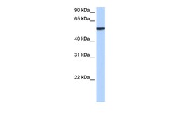 Aviva Systems Biology Corp CBX2 Antibody - N-terminal region (ARP51628_P050)