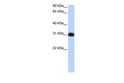 Aviva Systems Biology Corp MBNL2 Antibody - middle region (ARP51632_P050)