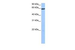Aviva Systems Biology Corp PAXIP1 Antibody - N-terminal region (ARP51642_P050)