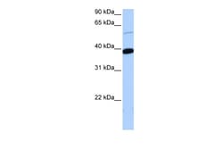 Aviva Systems Biology Corp ZNF562 Antibody - middle region (ARP51666_P050)