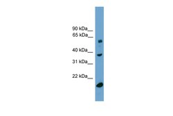 Aviva Systems Biology Corp TBL1Y Antibody - middle region (ARP51691_P050)