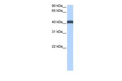 Aviva Systems Biology Corp MFSD3 Antibody - C-terminal region (ARP51707_P050)