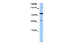 Aviva Systems Biology Corp TPRXL Antibody - C-terminal region (ARP51725_P050)