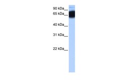 Aviva Systems Biology Corp ZNF90 Antibody - N-terminal region (ARP51752_P050)