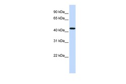 Aviva Systems Biology Corp F2R Antibody - N-terminal region (ARP51754_P050)
