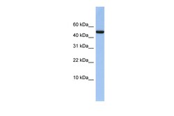 Aviva Systems Biology Corp ABAT Antibody - middle region (ARP51766_P050)