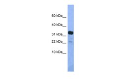 Aviva Systems Biology Corp Klhdc9 Antibody - middle region (ARP51793_P050)