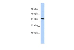 Aviva Systems Biology Corp DYSFIP1 Antibody - middle region (ARP51794_P050)