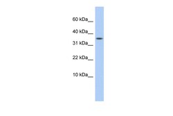 Aviva Systems Biology Corp DYSFIP1 Antibody - middle region (ARP51795_P050)