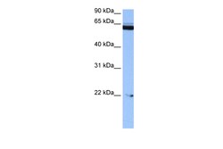 Aviva Systems Biology Corp C14orf174 Antibody - N-terminal region (ARP51813_P050)