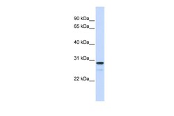 Aviva Systems Biology Corp FAM78B Antibody - middle region (ARP51830_P050)
