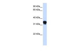 Aviva Systems Biology Corp CSNK1A1 Antibody - C-terminal region (ARP51843_P050)