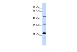 Aviva Systems Biology Corp FAM153B Antibody - middle region (ARP51873_P050)