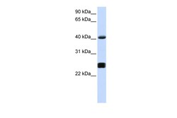 Aviva Systems Biology Corp SERPINA3 Antibody - middle region (ARP51880_P050)