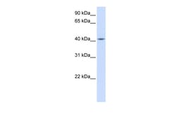 Aviva Systems Biology Corp FAM54A Antibody - middle region (ARP51899_P050)